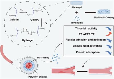 Bivalirudin-hydrogel coatings of polyvinyl chloride on extracorporeal membrane oxygenation for anticoagulation